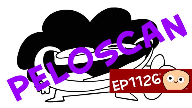 PeloScan (No .VEG, Fixed v2)