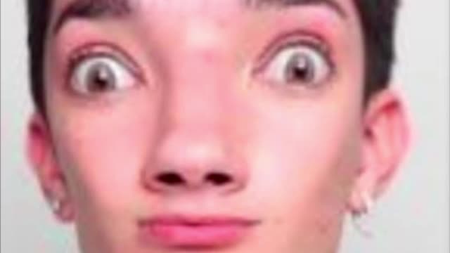Get a load of this retard