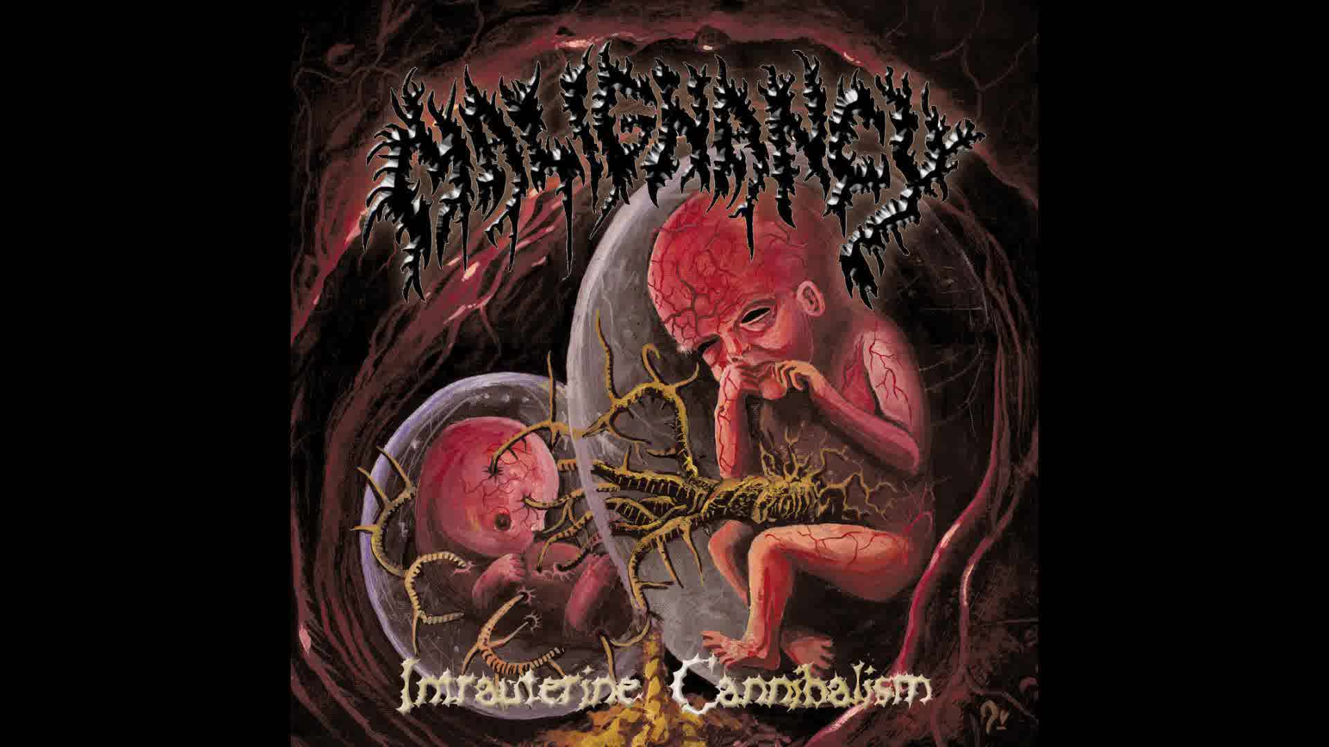 Malignancy - Intrauterine Cannibalism (Full Album Stream)